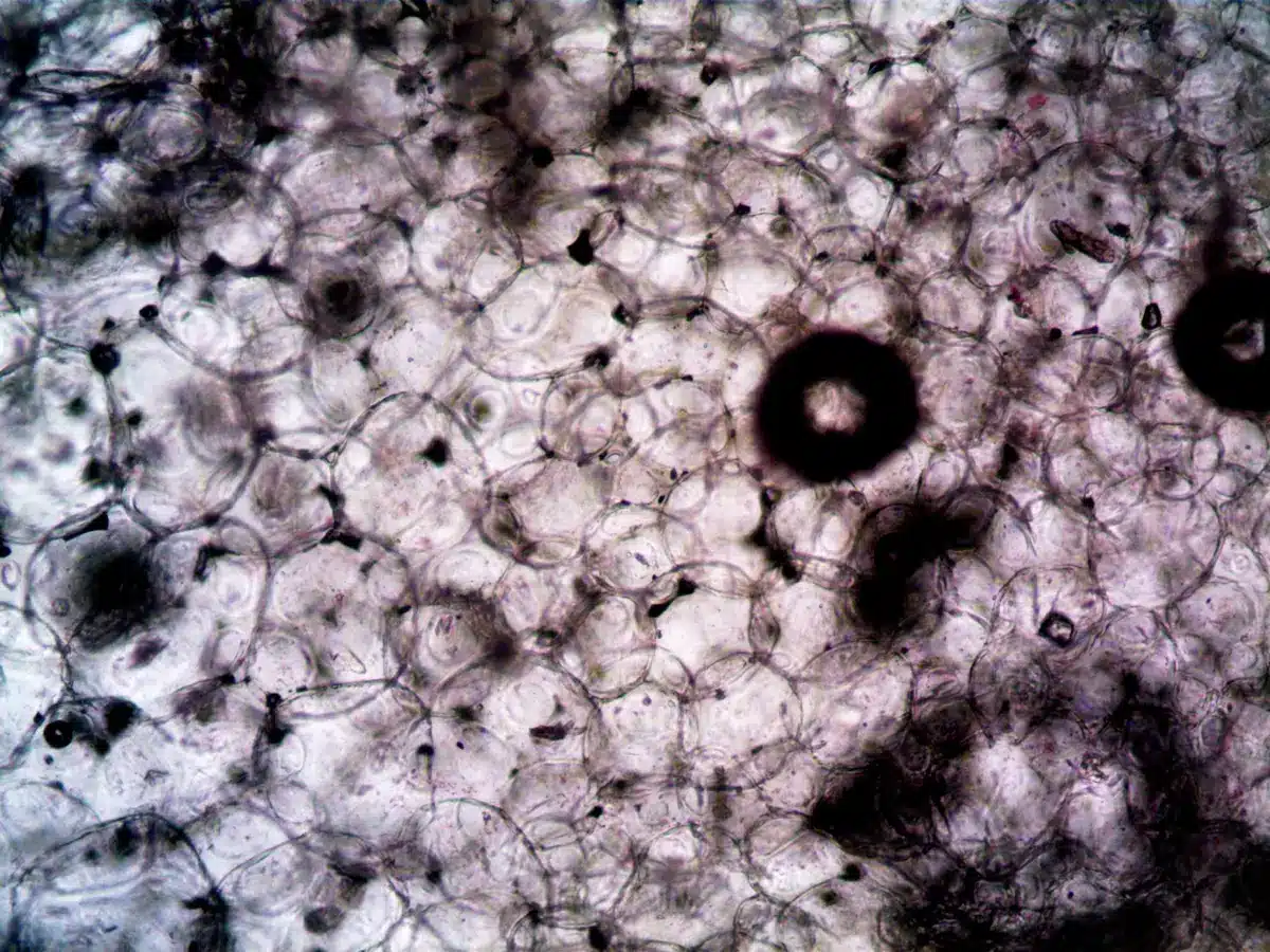 Microscopic view of brain tissue sample under laboratory examination