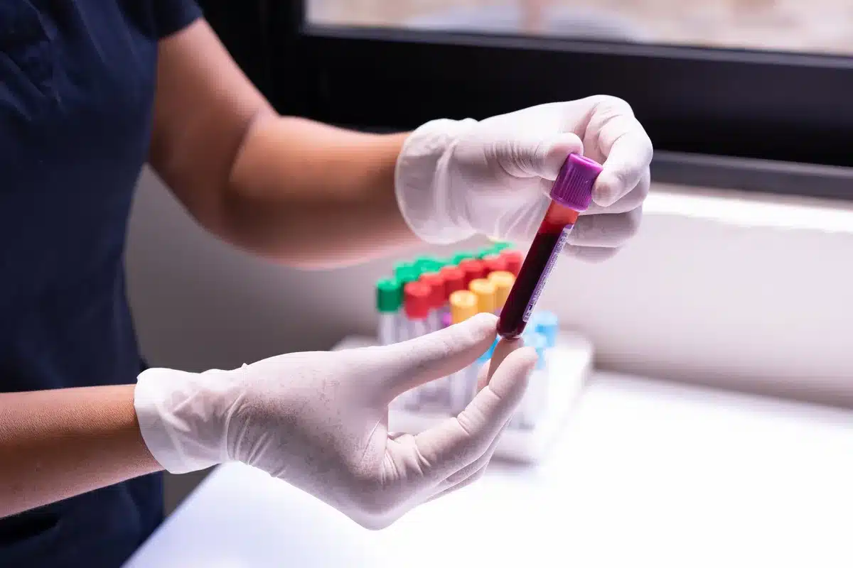 Laborant mit Blutproben und medizinischen Geräten bei der Diagnoseuntersuchung
