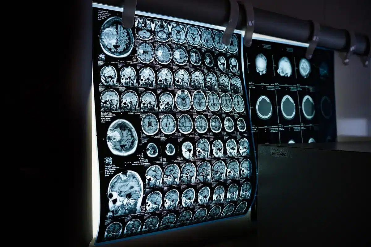 Microscopic view of brain tissue sample under laboratory lighting